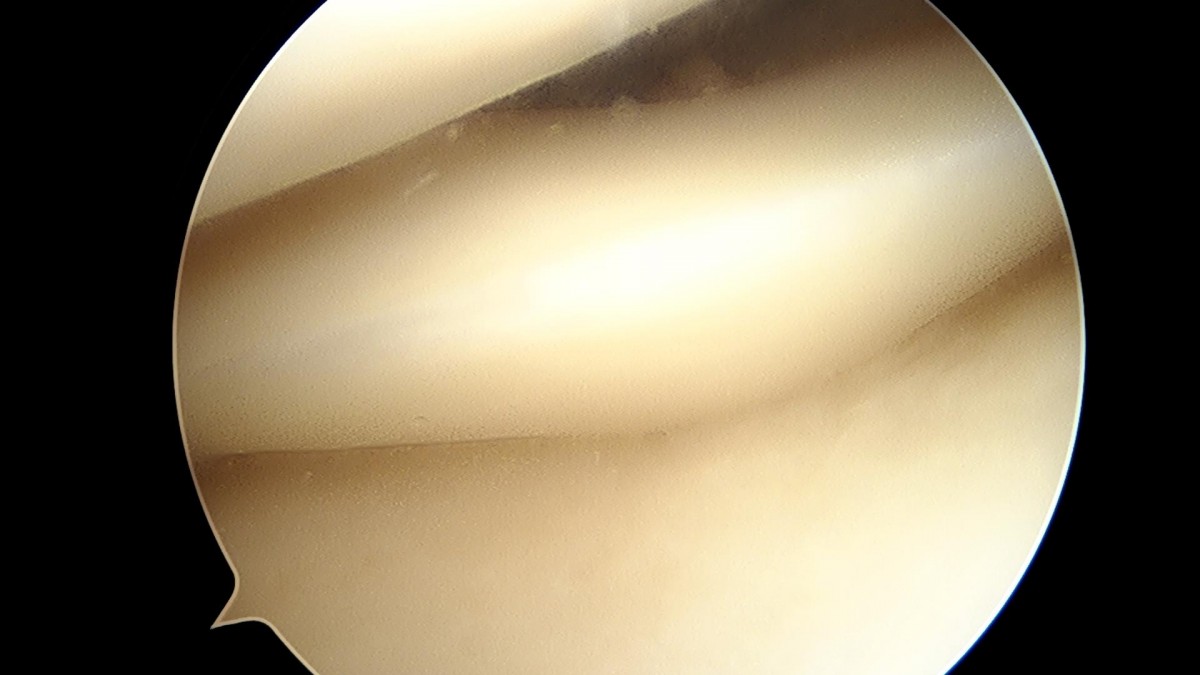 f701f577d2a1d4abc2e781cde09fc22f_1645594581_2617.jpg
