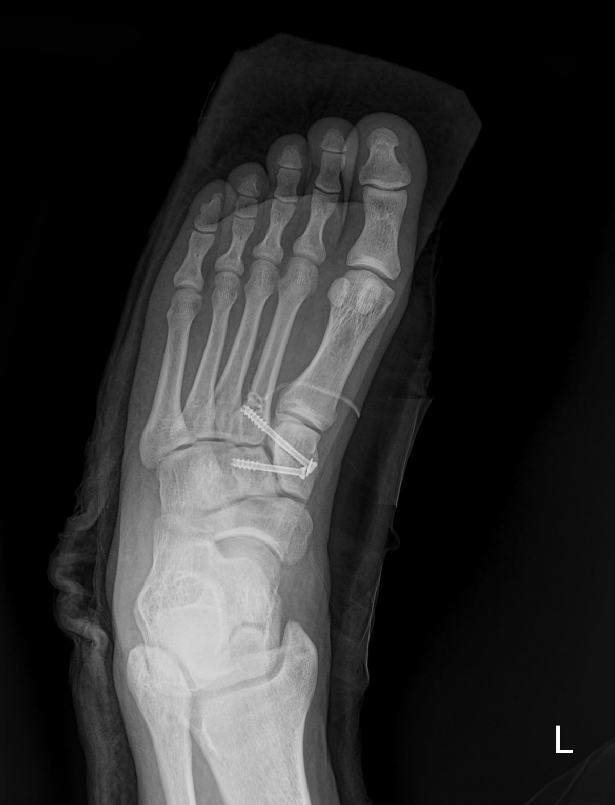 f701f577d2a1d4abc2e781cde09fc22f_1645594942_2222.jpg