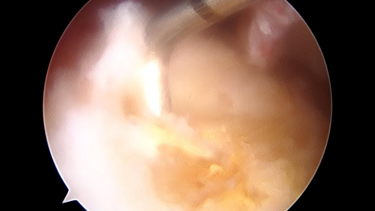 f701f577d2a1d4abc2e781cde09fc22f_1645595800_0914.jpg