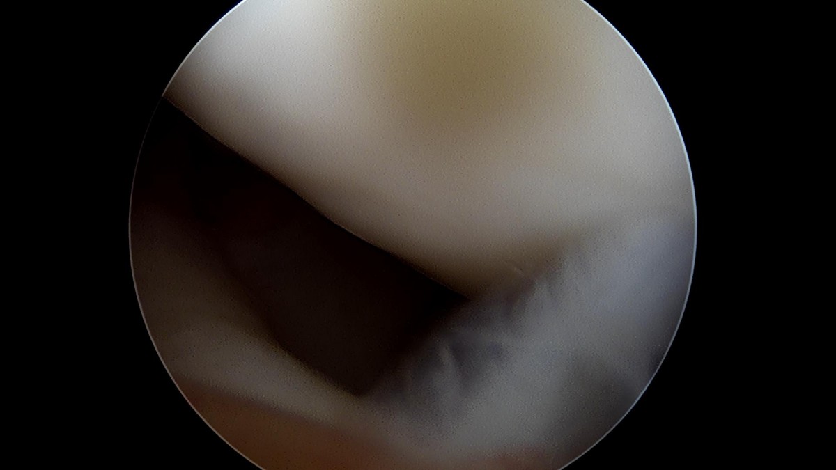 f701f577d2a1d4abc2e781cde09fc22f_1645597613_0535.jpg