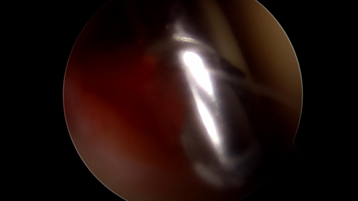 f701f577d2a1d4abc2e781cde09fc22f_1645597698_663.jpg
