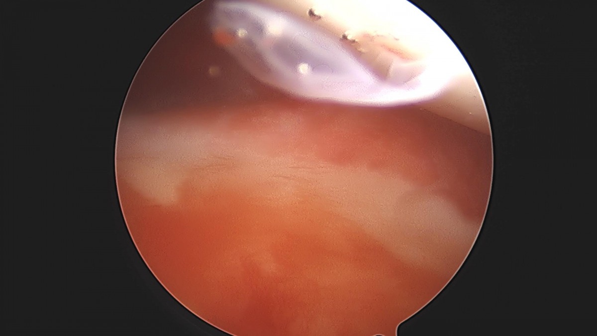 3cd48a8e02e388456e21d82dd041ccef_1652064959_9891.jpg