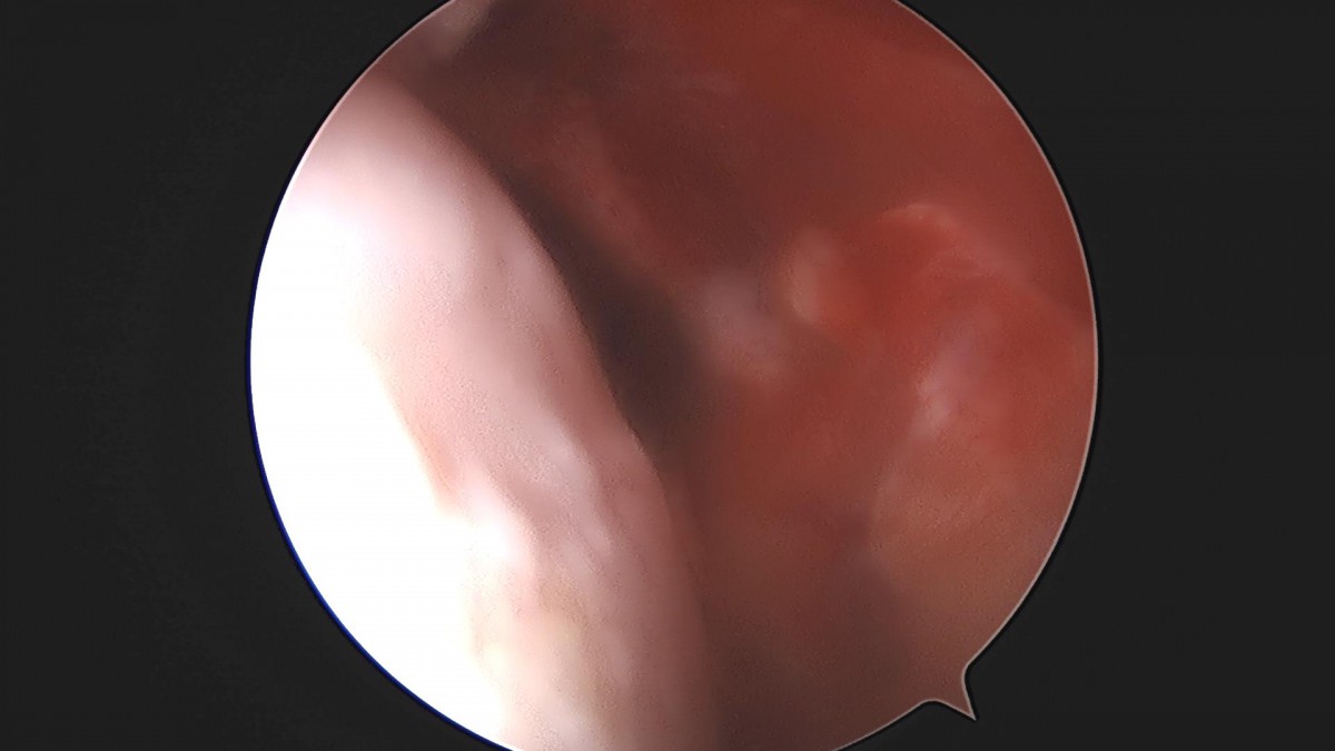 3cd48a8e02e388456e21d82dd041ccef_1652064961_2948.jpg
