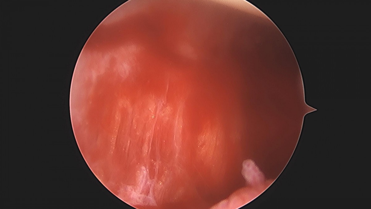 3cd48a8e02e388456e21d82dd041ccef_1652064962_1969.jpg