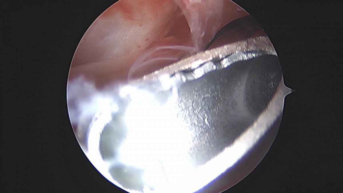 3cd48a8e02e388456e21d82dd041ccef_1652064964_099.jpg