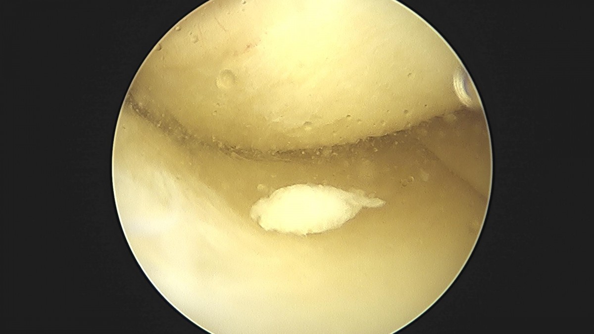 3cd48a8e02e388456e21d82dd041ccef_1652065604_2393.jpg