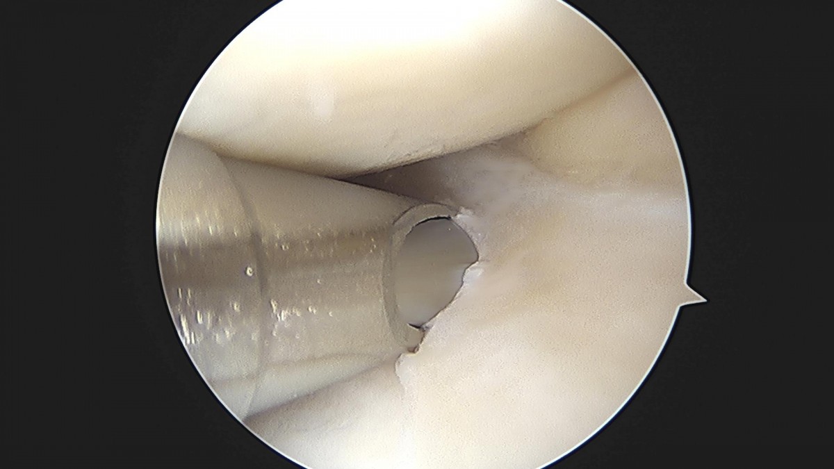 3cd48a8e02e388456e21d82dd041ccef_1652065614_0593.jpg