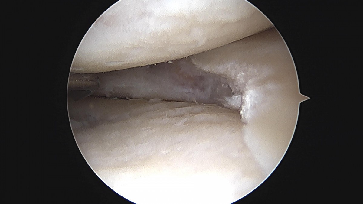 3cd48a8e02e388456e21d82dd041ccef_1652065620_0154.jpg