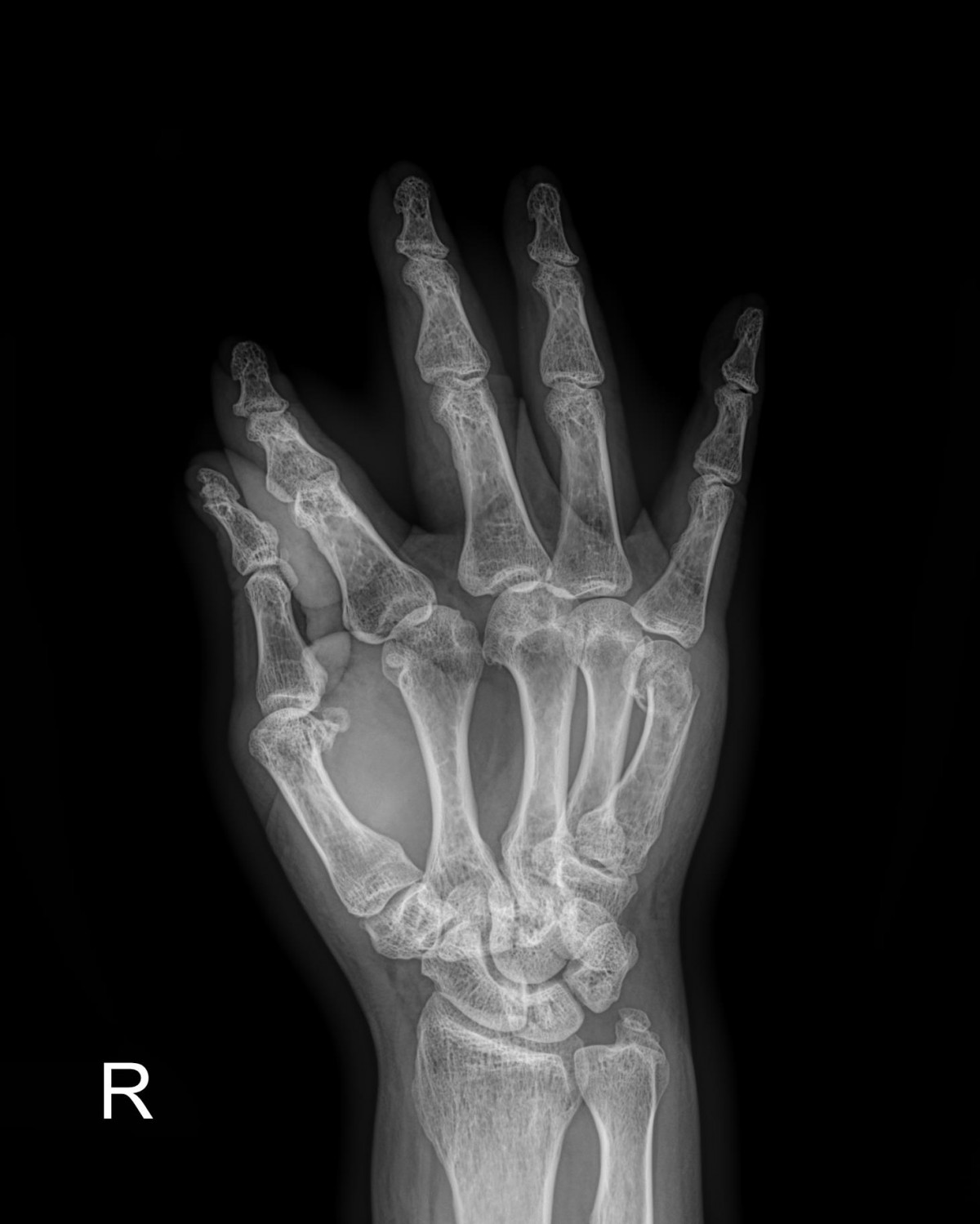 3cd48a8e02e388456e21d82dd041ccef_1652065965_2677.jpg