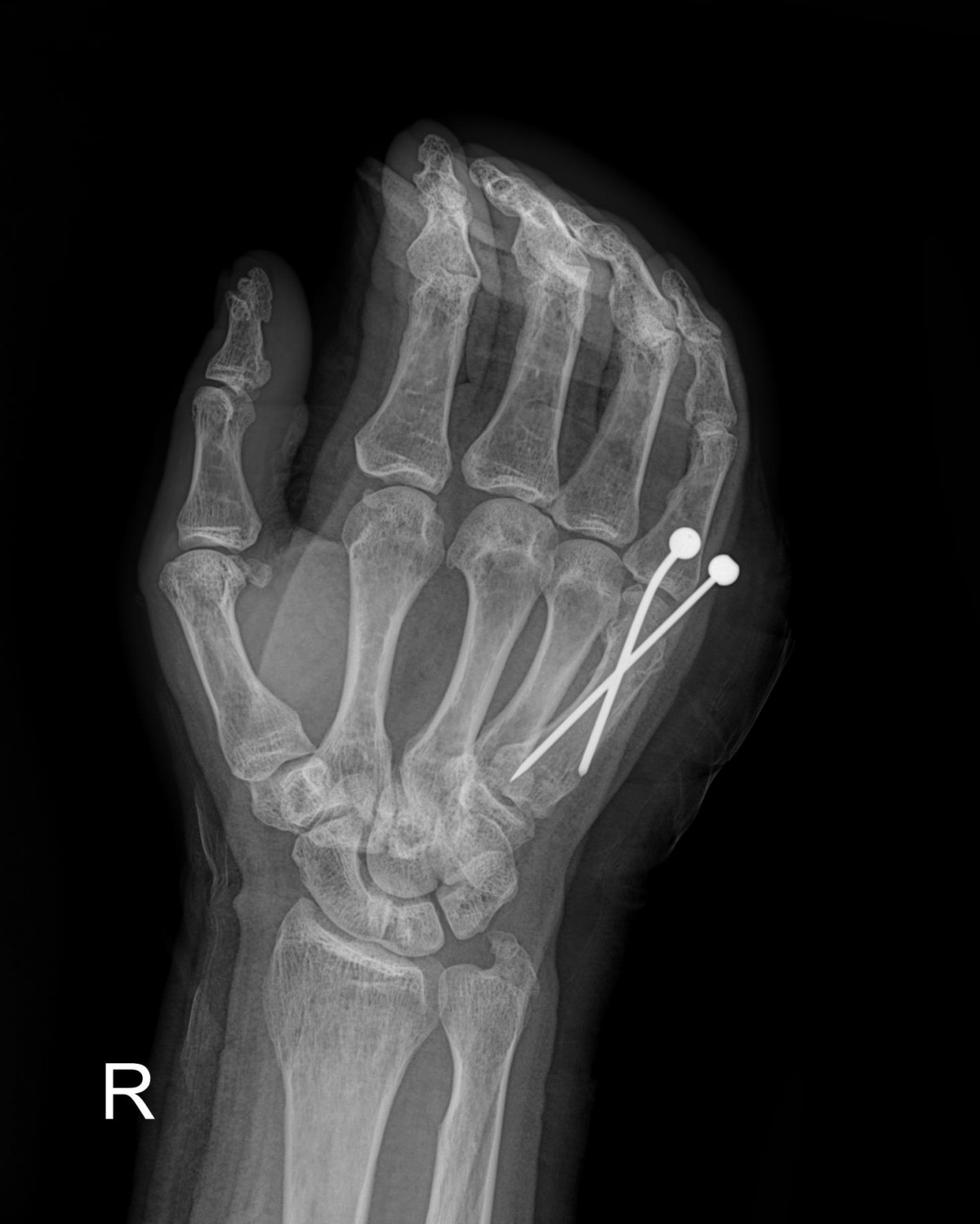 3cd48a8e02e388456e21d82dd041ccef_1652065989_8992.jpg