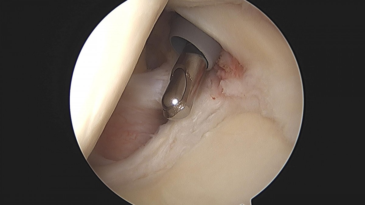 3cd48a8e02e388456e21d82dd041ccef_1652066125_4454.jpg