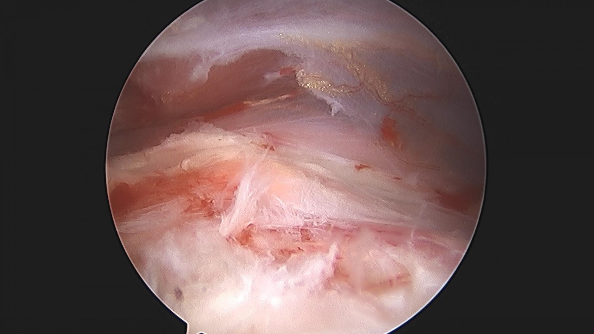3cd48a8e02e388456e21d82dd041ccef_1652066138_4876.jpg