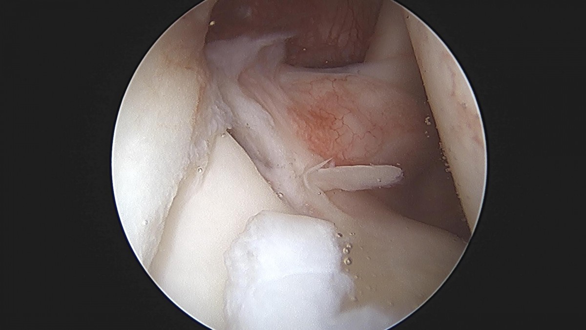 3cd48a8e02e388456e21d82dd041ccef_1652066318_8387.jpg