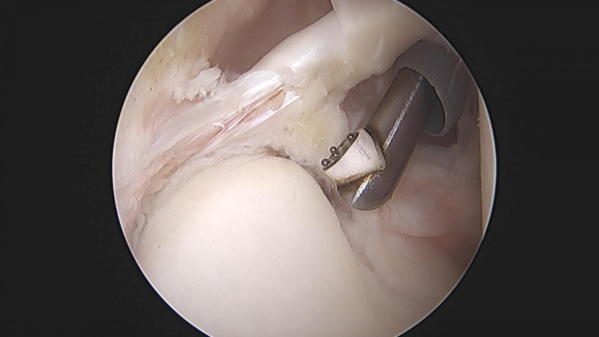 3cd48a8e02e388456e21d82dd041ccef_1652066322_8651.jpg