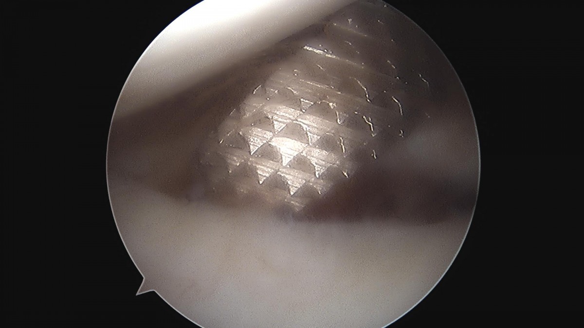 3cd48a8e02e388456e21d82dd041ccef_1652066350_588.jpg