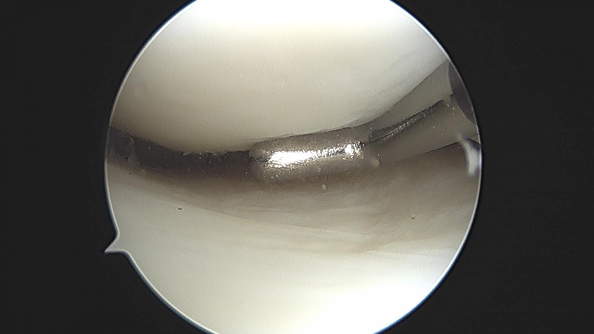 3cd48a8e02e388456e21d82dd041ccef_1652066510_0022.jpg