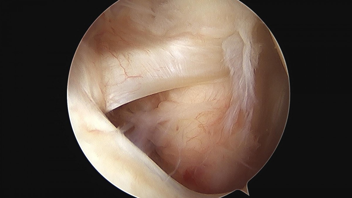 3cd48a8e02e388456e21d82dd041ccef_1652066630_6158.jpg