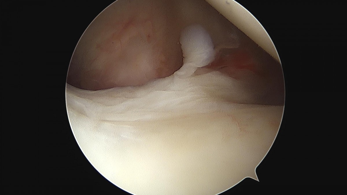 3cd48a8e02e388456e21d82dd041ccef_1652066631_3187.jpg