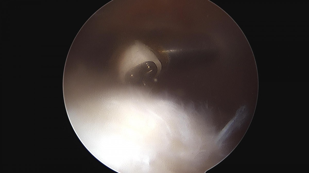 3cd48a8e02e388456e21d82dd041ccef_1652066634_624.jpg