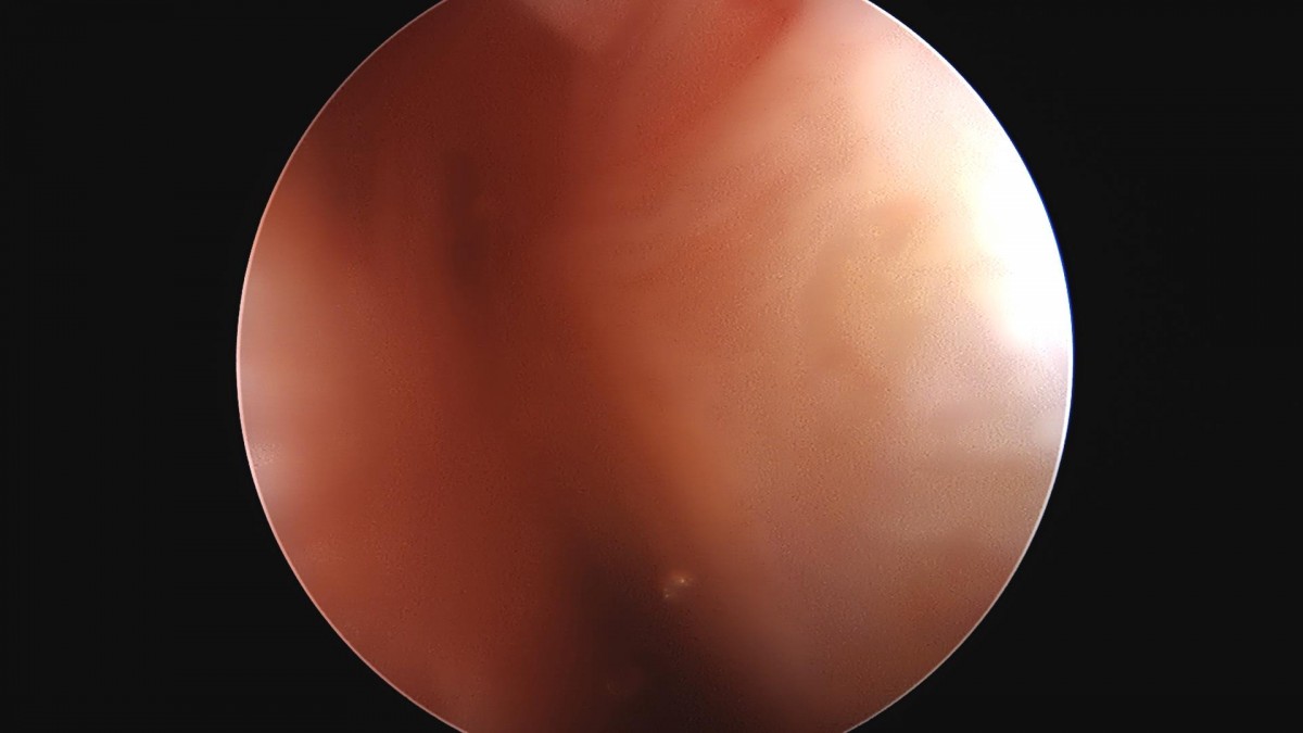 3cd48a8e02e388456e21d82dd041ccef_1652066839_3938.jpg
