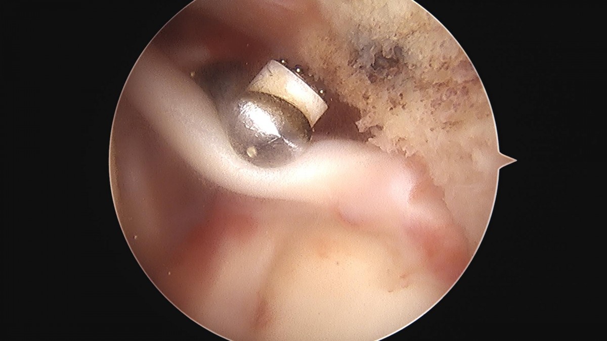 3cd48a8e02e388456e21d82dd041ccef_1652066841_3852.jpg