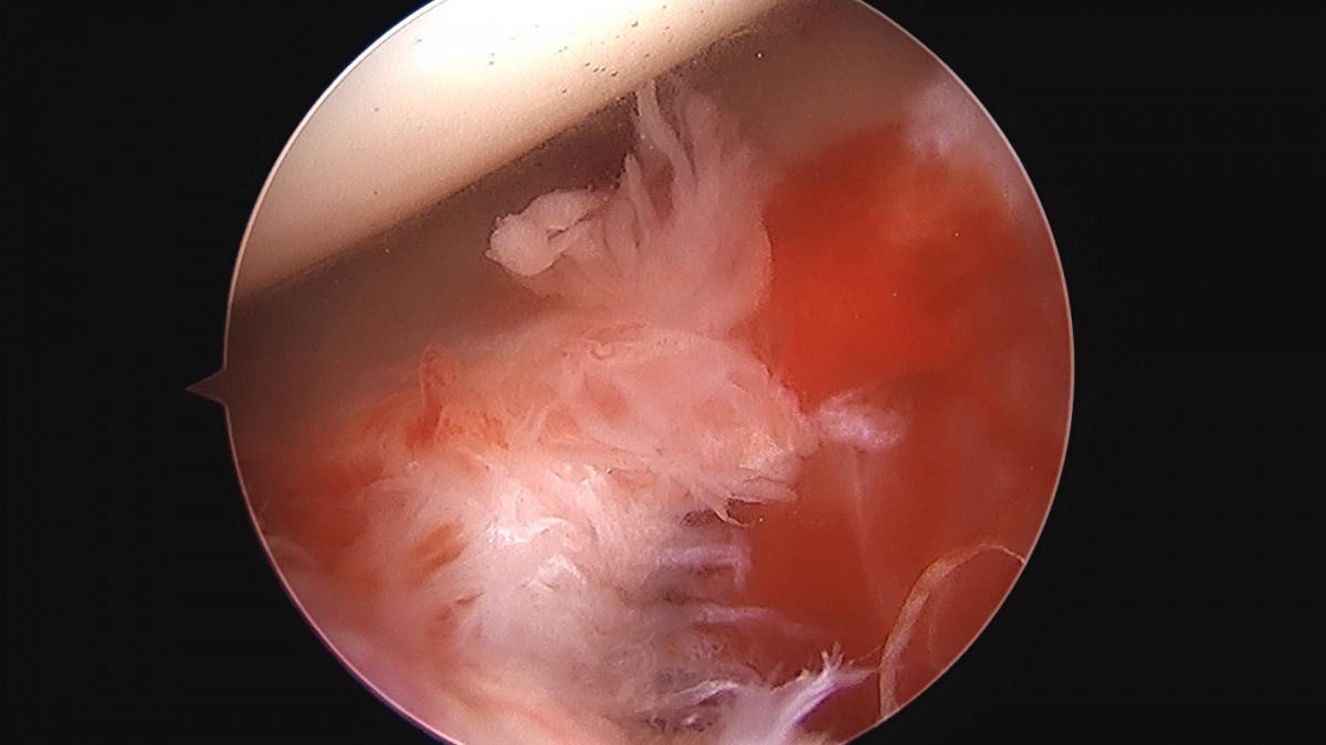 3cd48a8e02e388456e21d82dd041ccef_1652066842_0865.jpg