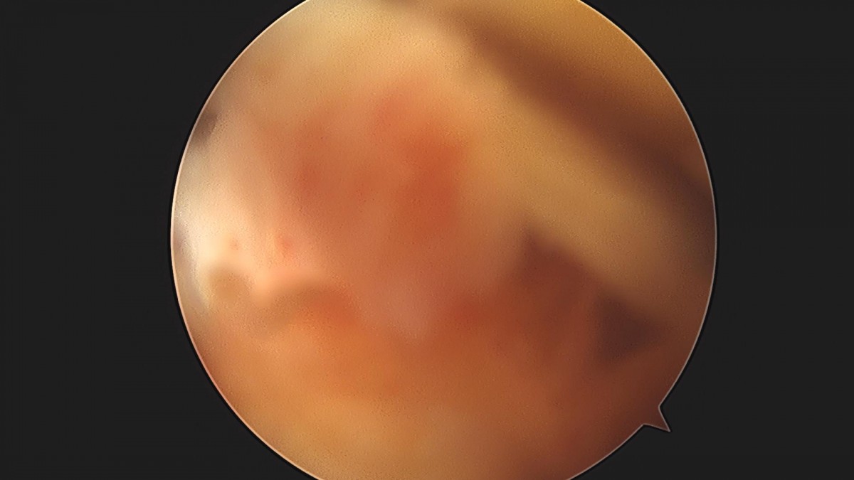 3cd48a8e02e388456e21d82dd041ccef_1652067243_8097.jpg