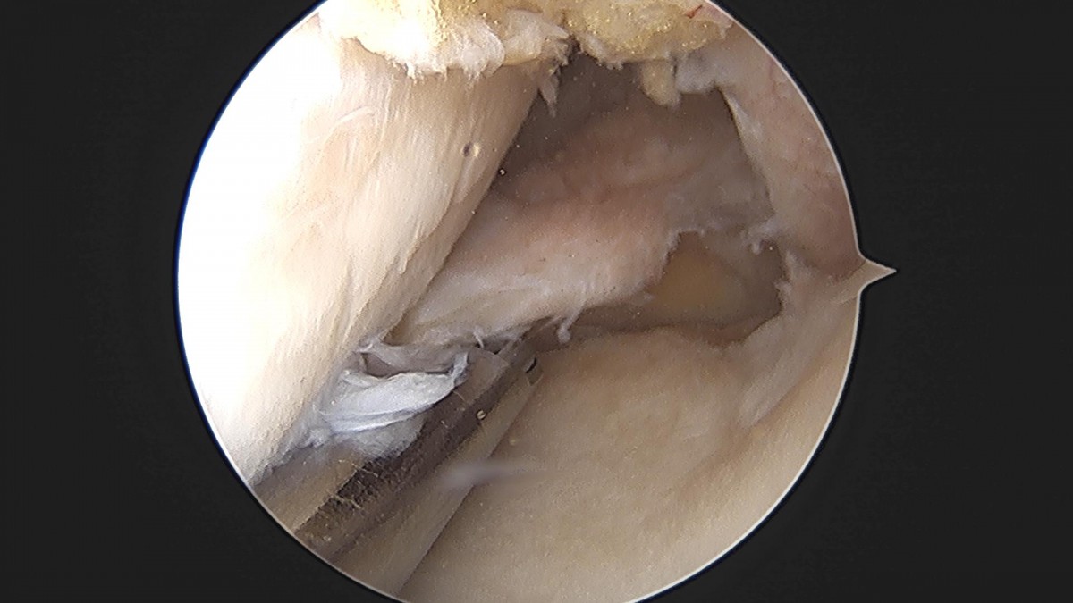 3cd48a8e02e388456e21d82dd041ccef_1652067426_7433.jpg