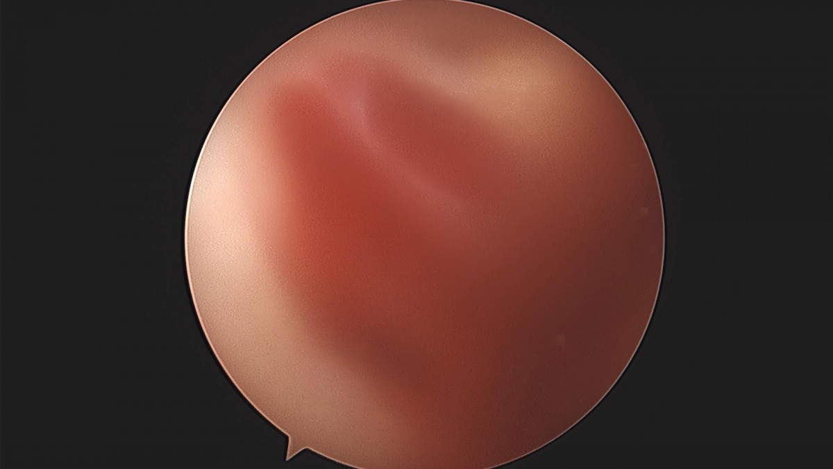 3cd48a8e02e388456e21d82dd041ccef_1652067805_7027.jpg