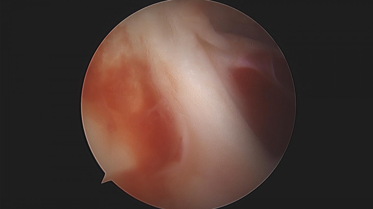 3cd48a8e02e388456e21d82dd041ccef_1652067806_3902.jpg