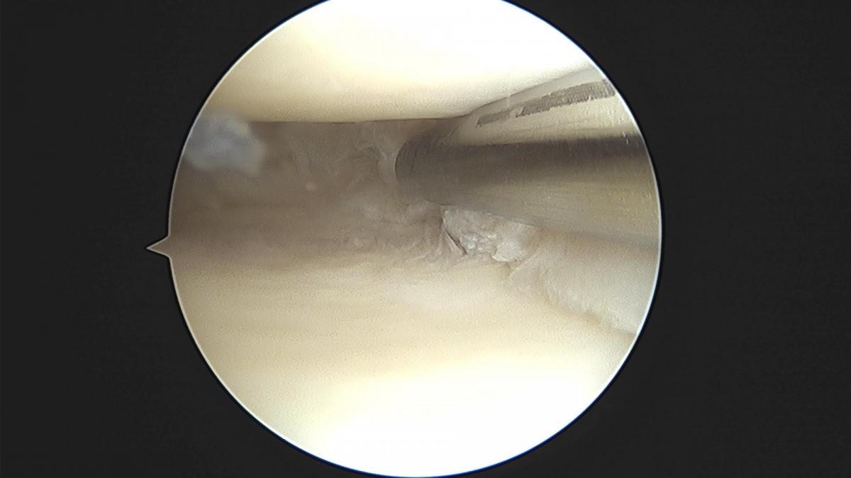 3cd48a8e02e388456e21d82dd041ccef_1652068032_9143.jpg