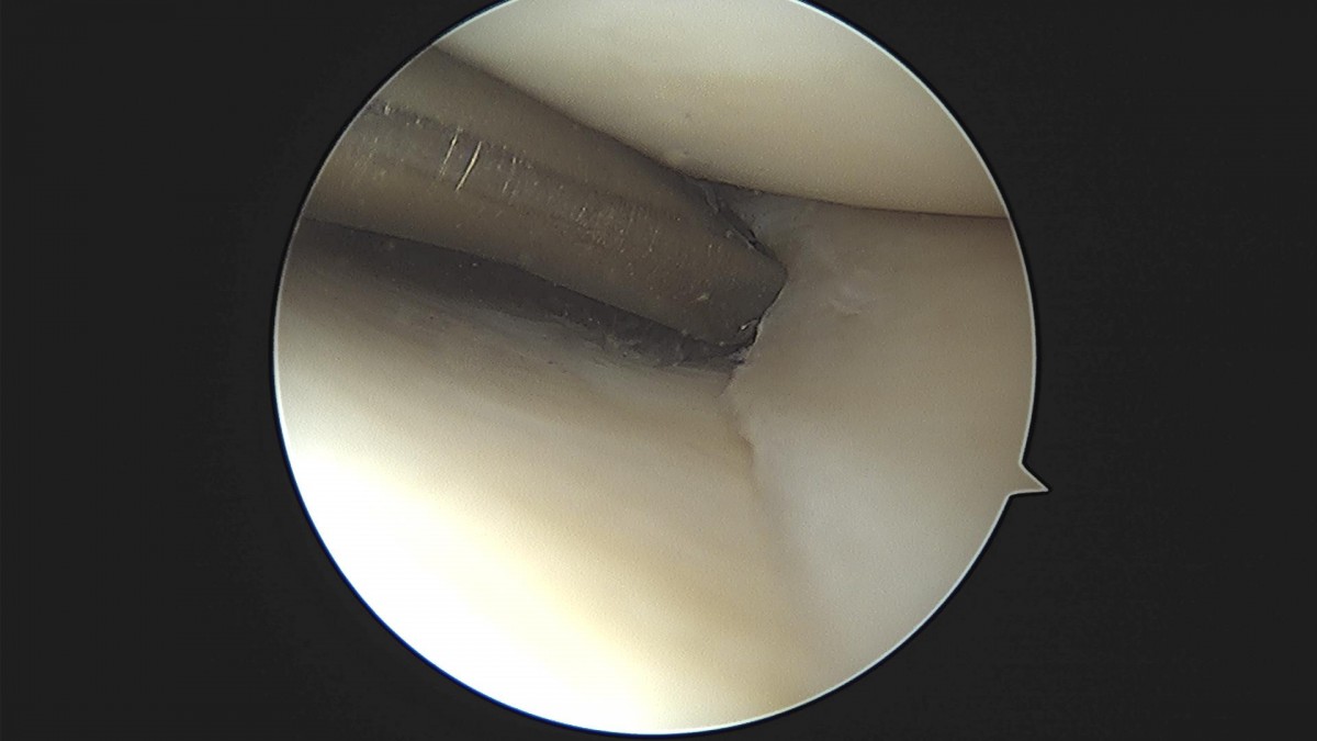 3cd48a8e02e388456e21d82dd041ccef_1652068035_0135.jpg