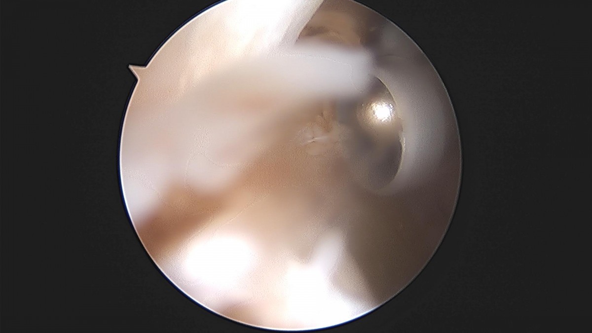 3cd48a8e02e388456e21d82dd041ccef_1652068335_2371.jpg