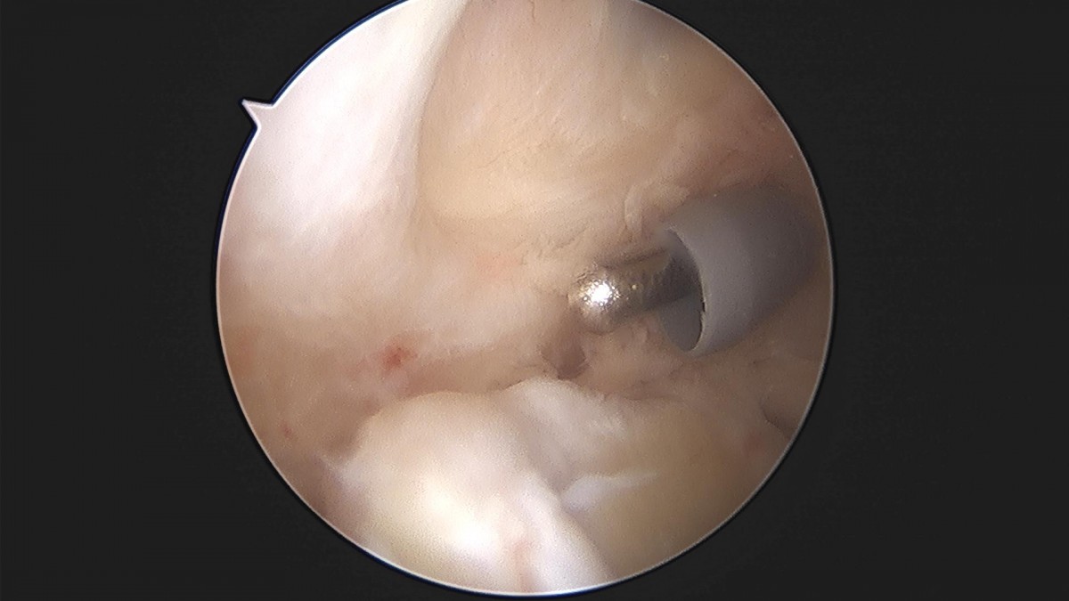3cd48a8e02e388456e21d82dd041ccef_1652068335_8976.jpg