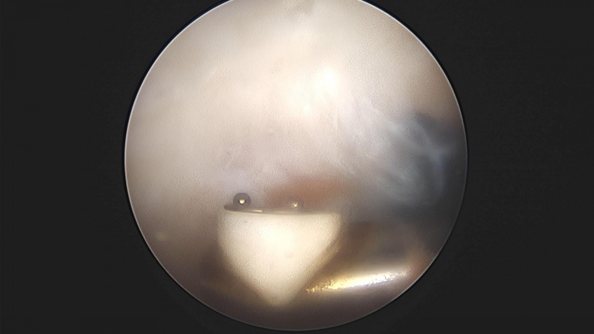 3cd48a8e02e388456e21d82dd041ccef_1652068338_5792.jpg