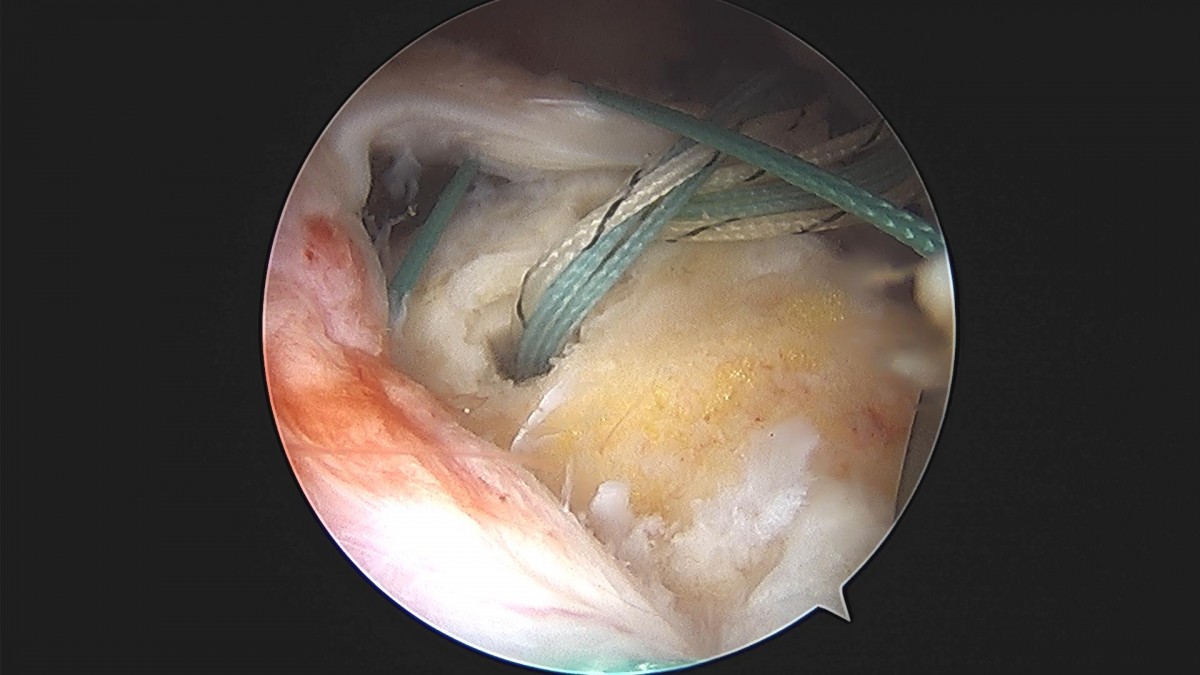 3cd48a8e02e388456e21d82dd041ccef_1652068350_0614.jpg