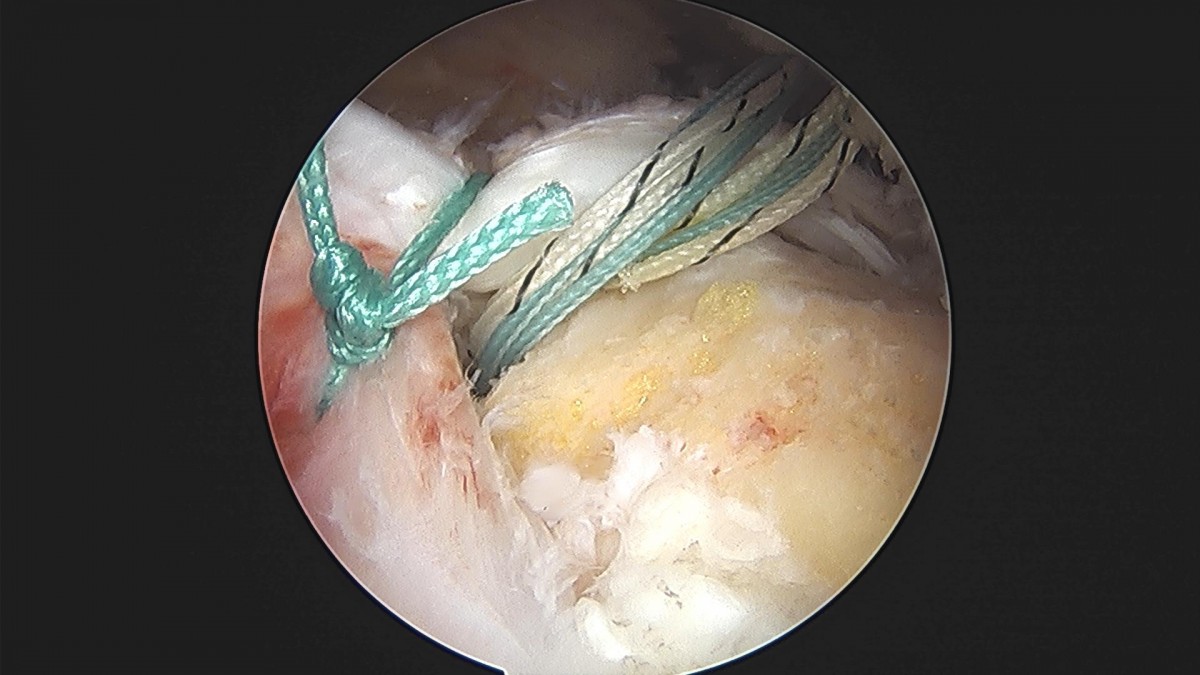 3cd48a8e02e388456e21d82dd041ccef_1652068350_7209.jpg