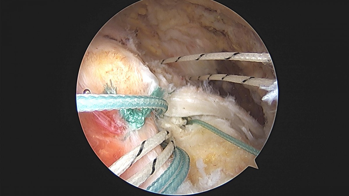 3cd48a8e02e388456e21d82dd041ccef_1652068351_4198.jpg
