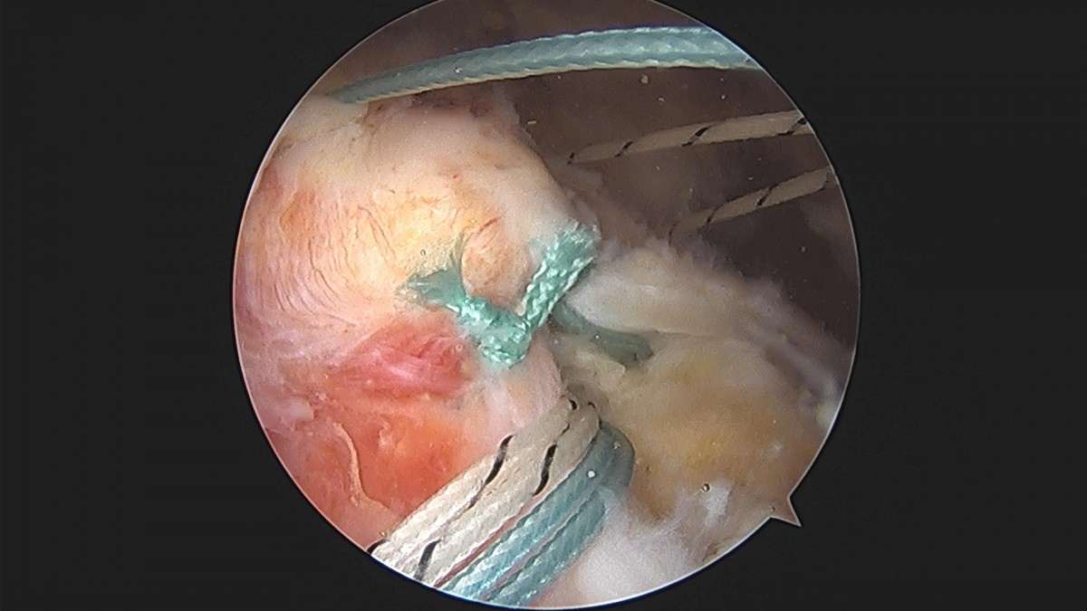 3cd48a8e02e388456e21d82dd041ccef_1652068352_0664.jpg