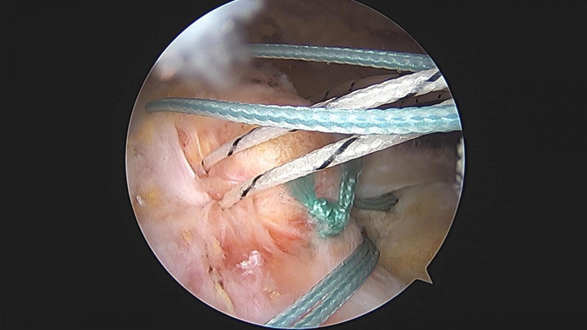3cd48a8e02e388456e21d82dd041ccef_1652068353_3619.jpg