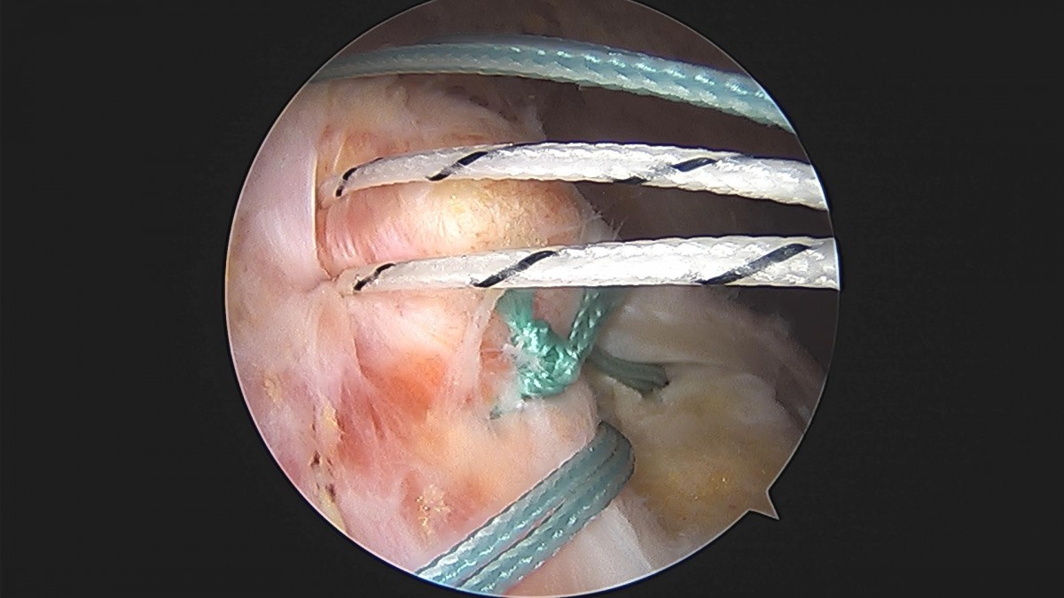3cd48a8e02e388456e21d82dd041ccef_1652068353_9969.jpg