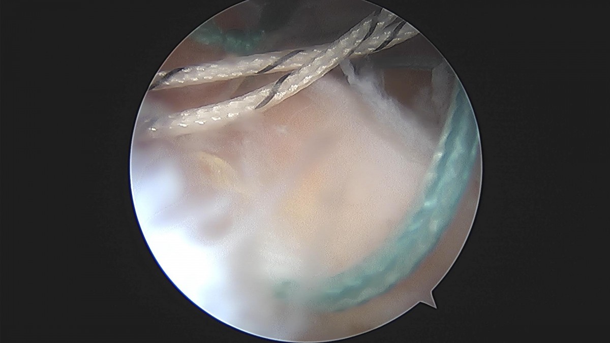 3cd48a8e02e388456e21d82dd041ccef_1652068355_347.jpg
