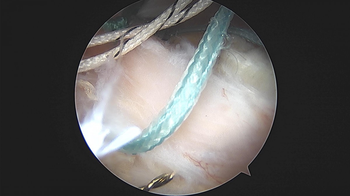 3cd48a8e02e388456e21d82dd041ccef_1652068355_9886.jpg
