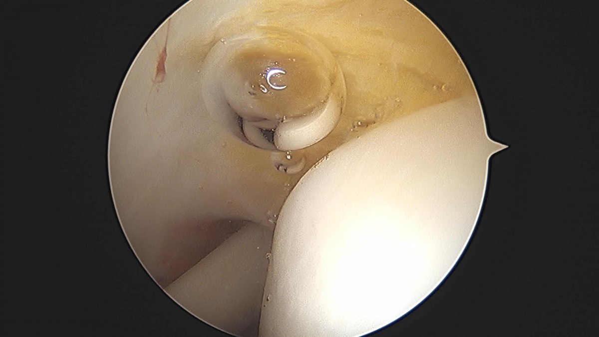3cd48a8e02e388456e21d82dd041ccef_1652069153_9165.jpg