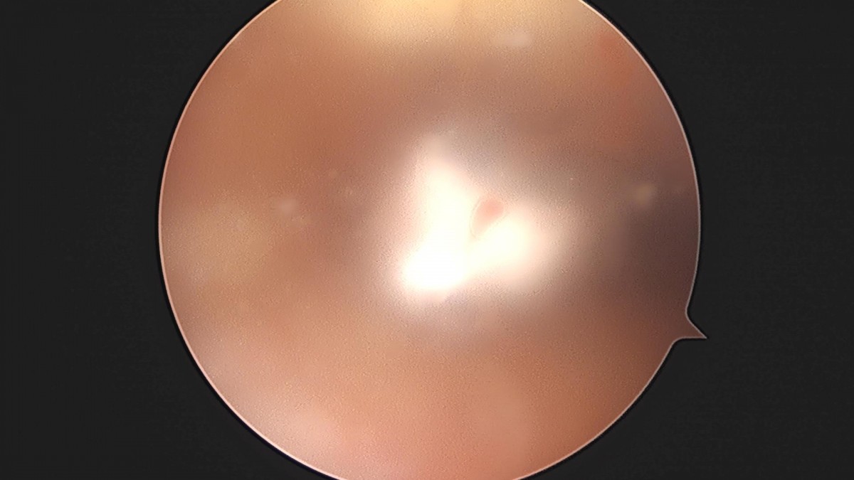 3cd48a8e02e388456e21d82dd041ccef_1652069157_2248.jpg