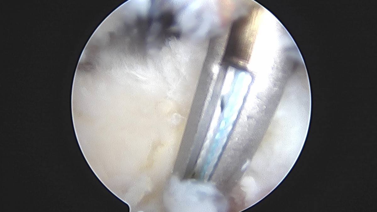 3cd48a8e02e388456e21d82dd041ccef_1652069171_6296.jpg