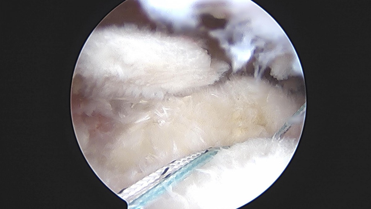 3cd48a8e02e388456e21d82dd041ccef_1652069172_9395.jpg