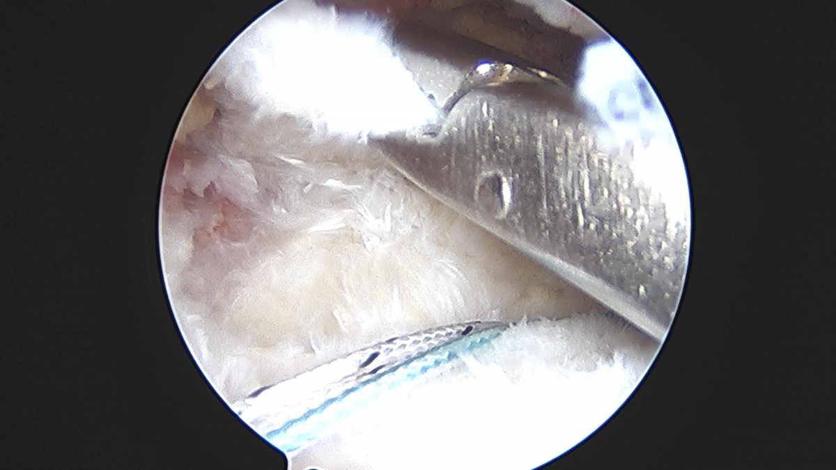 3cd48a8e02e388456e21d82dd041ccef_1652069173_6308.jpg