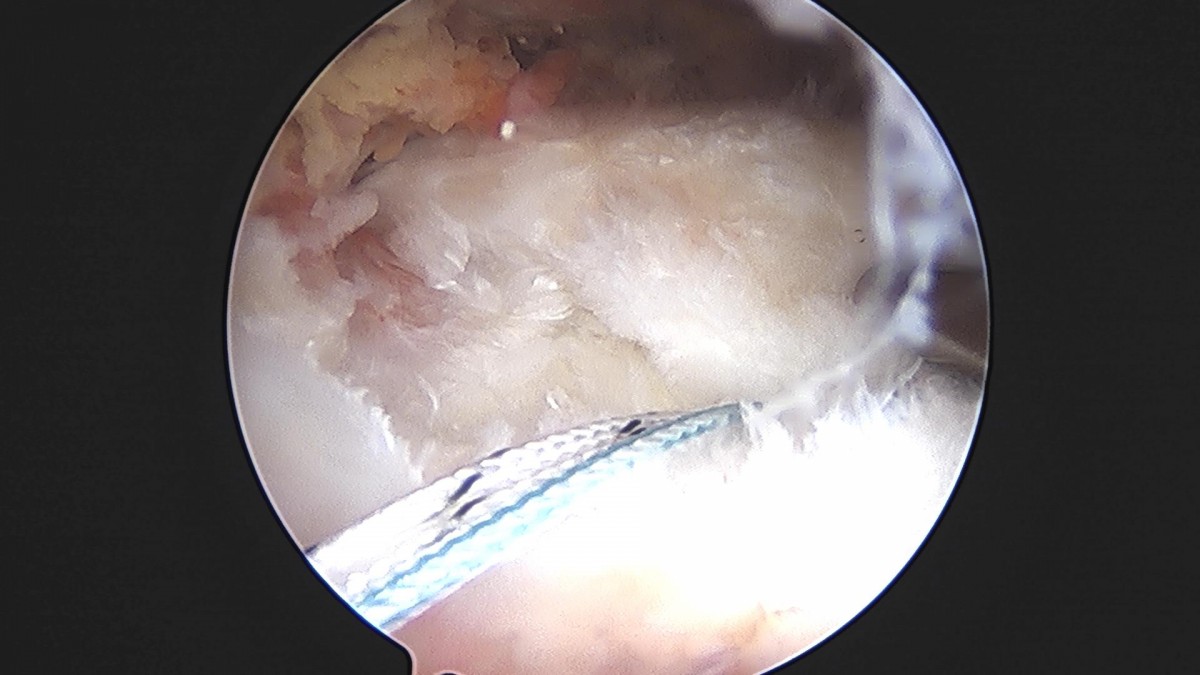 3cd48a8e02e388456e21d82dd041ccef_1652069174_2856.jpg