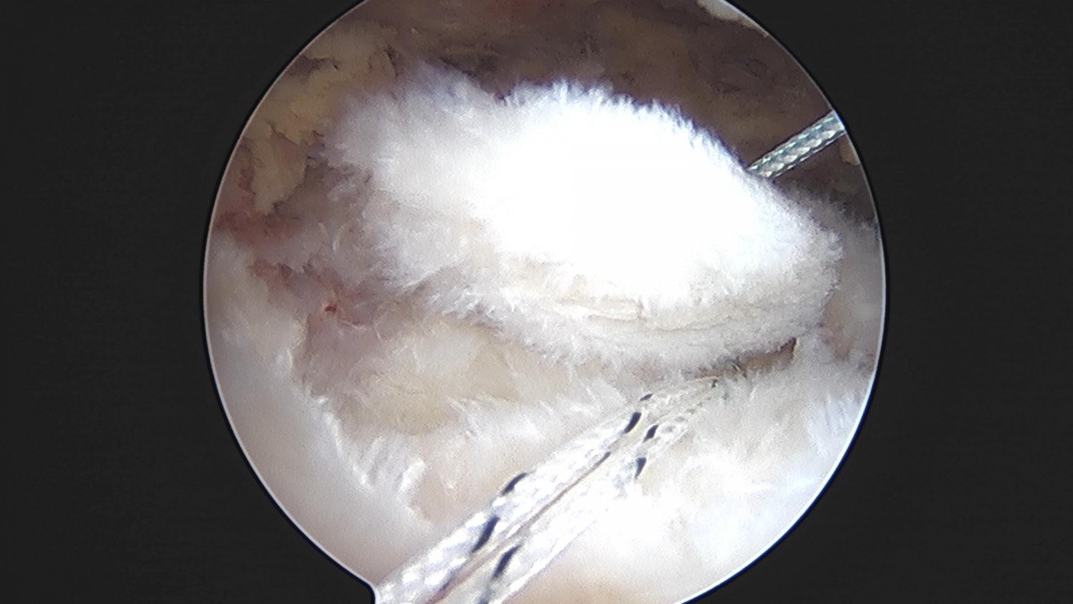 3cd48a8e02e388456e21d82dd041ccef_1652069174_9839.jpg